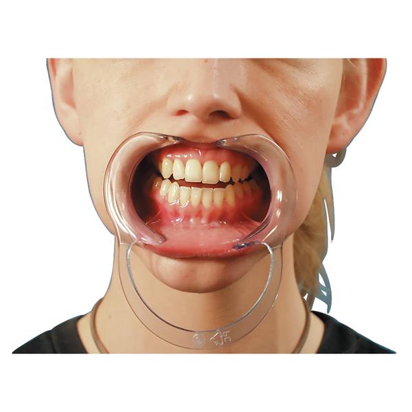 Spandex Lip & Cheek Retractor Adult